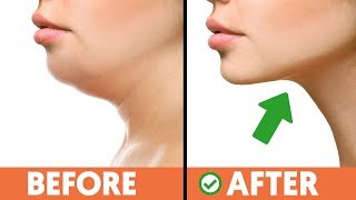5 Exercise Techniques For Getting Rid of That Double Chin Fast!