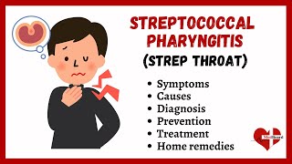 What is Streptococcal Pharyngitis? | Strep Throat Made Astoundingly Simple