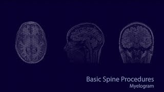 Basic neuroradiology procedures part 3 - Myelogram