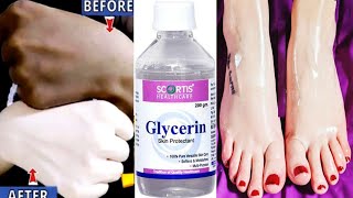 Glycerin में बस ये चीज मिला कर लगालो रातो-रात हाथ पैर दूध सा गोरे और सॉफ्ट हो जाएंगे /100%effective