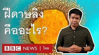 ทำความเข้าใจ 'โรคฝีดาษลิง' ใน 3 นาที - BBC News ไทย