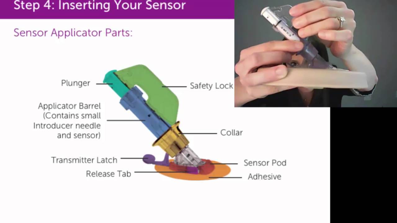 Difference Between Dexcom Sensor And Transmitter At Mabel Singer Blog