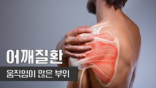 누구나 겪을 수 있는 질병, 어깨질환 I 어깨질환 I 정용인 정형외과 전문의 I 건강플러스