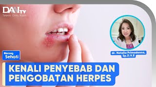 Kenali Penyebab Herpes | Bincang Sehati