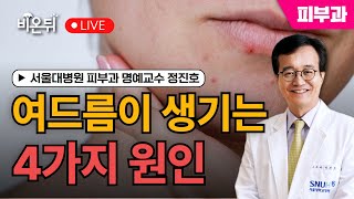 [정진호쇼, 젊어지는 피부 건강한 피부] 여드름이 생기는 4가지 원인 / 서울대병원 피부과 정진호