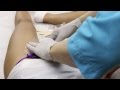 Download Brazilian Wax in Manhattan New York.Brazilian Waxing Hair Removal For Women NYC In Mp4 3Gp Full HD Video