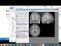 2015.10.04 rsfmri實作課程 1，盧家鋒老師教授