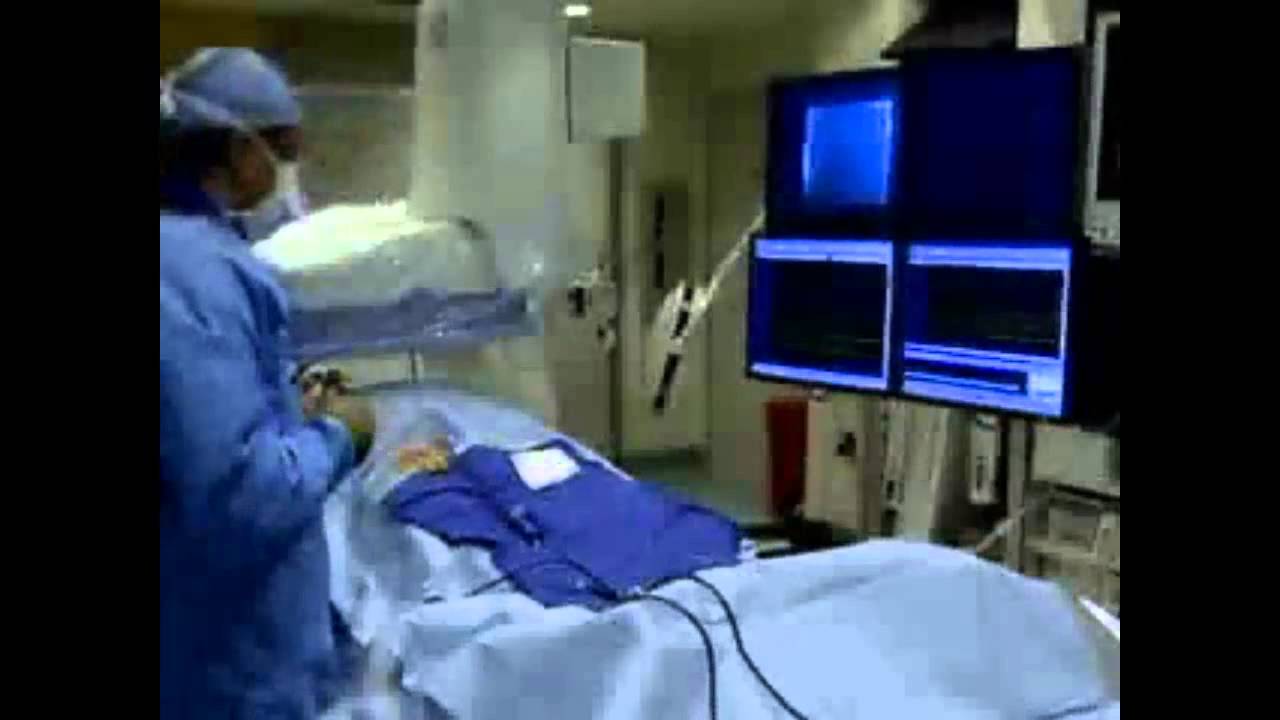 An Electrophysiology Study - YouTube