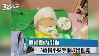 車禍顱內出血　3歲楊小妹手術取出血塊