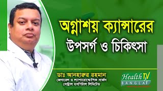 অগ্নাশয় ক্যান্সারের লক্ষণ ও চিকিৎসা | Pancreatic Cancer Symptoms and Treatment | Health Tv Bangla