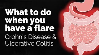 What to do if you have a Crohn's disease or ulcerative colitis flare | GI Society
