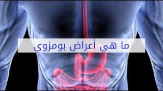 القولون العصبي أو  بومزوي  - الأستاذ يوسف الحماوي - الحلقة 29