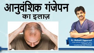 Best treatment for baldness. Best Treatment of Male \u0026 Female Pattern Hair Loss | Hair Solutions - Ep 4