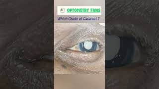 Identify Grade of Cataract  ?