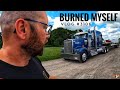 BURNED MYSELF | My Trucking Life | Vlog #3106