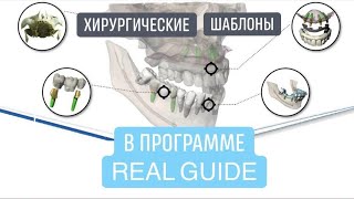 Основы моделирования хирургических шаблонов в программе Real Guide