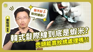 韓式髮際線到底是蝦米?禿頭能靠紋綉處理嗎?!｜毛爵生髮診所