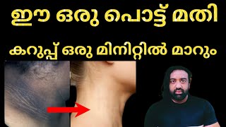 കഴുത്തിന് ചുറ്റുമുള്ള കറുപ്പ് മാറാൻ | How to remove dark black patches malayalam