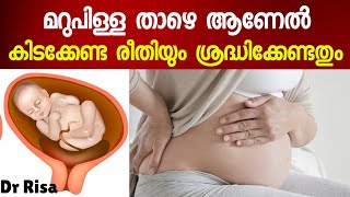 Low Lying Placenta| Placenta Previa|മറു താഴെ ആണേൽ കിടക്കേണ്ട രീതിയും ശ്രദ്ധിക്കേണ്ടതും