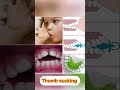 പല്ലിലെ തള്ളൽ വരാതെ തടയാം⁉️ dentist dentalcare toothbraces orthotreatment bracespain