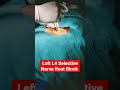 Left L4 Selective Nerve Root Block ..Dr Sai Chandra