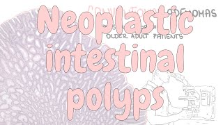 Neoplastic intestinal polyps - digestive system pathology