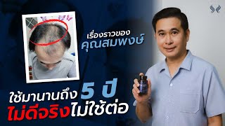 EP 25: บุคลากรทางการแพทย์ใช้ HERRMETTO กว่า 5 ปี ผมขึ้นจริงหรือตัดต่อ ?