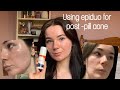 Starting Epiduo for acne! 4 week update + tips 💖