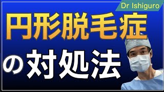 円形脱毛症の対処法は？