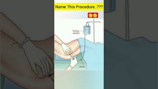 enima medical procedure।।#enema#medicalprocedure#viralshorts#youtubeshorts #shorts