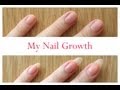 Nail Growth And Cutting My Stiletto Nails (time lapse) Nail Growth And Cutting My Stiletto Nails (time lapse)