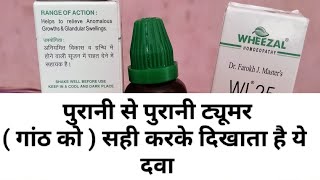 Wheezal Homoeopathy|WL 25 Drops/Tumor drops|| dr farokh j masters|| 💯% गांठ सही करें