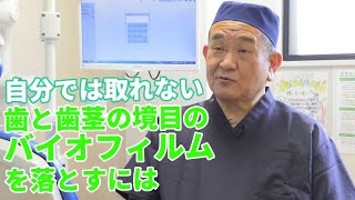 【歯医者さんTV】自分では取れない 歯と歯茎の境目のバイオフィルムを落とすには