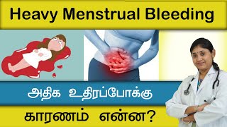 அதிக உதிரபோக்கு  காரணம் என்ன?  heavy menstrual bleeding