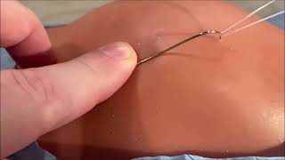 Fishhook Removal: Quick & Easy!