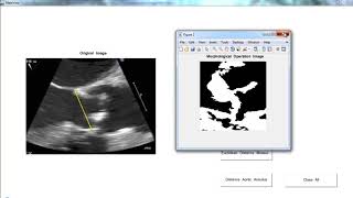 Project Topics Related to Image Processing | Thesis Topics Related to Image Processing