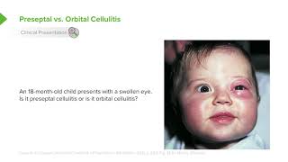 15 Orbital Cellulitis and Preseptal Cellulitis  Pathology & Clinical Presentation