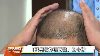 1104中視精選2 生髮沒用對方法 台男30天長滿頭髮