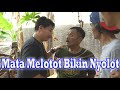 Mata Melotot Bikin Nyolot