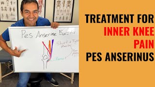How To Cure Inner Knee Pain Caused By Pes Anserine Bursitis [Easy Self Treatment That Works]