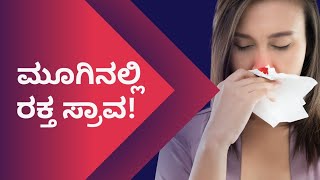 ಮೂಗಿನಲ್ಲಿ ರಕ್ತ ಸ್ರಾವ | NOSE BLEED | DR VENKATRAMANA HEGDE | NISARGA MANE | NATUROPATHY