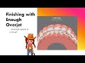 Invisalign ClinCheck - Finishing with Enough Overjet