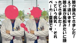 膝が腫れると言っても、膝の裏が腫れる病気があります。ベーカー嚢腫といいます。どんな病気でしょうか？