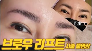 [눈썹] 브로우 리프트 브로우 펌 시술 풀영상 - Brow Lift Brow Lamination Brow Perm