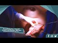 Breast Reduction, Arm Lift, Tummy Tuck Revision, 360 Liposuction