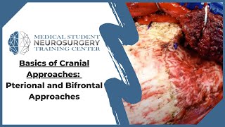 Basics of Cranial Approaches: Pterional and Bifrontal Approaches