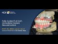 Fully Guided Full Arch Immediate Implant Reconstruction