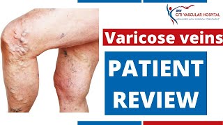 Varicose veins Happy Patient Review | Happy Patient After Varicose veins Surgery