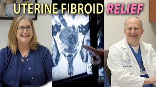 How are Uterine Fibroids Treated?
