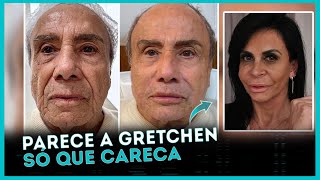 Stênio Garcia faz HARMONIZAÇÃO facial aos 91 anos